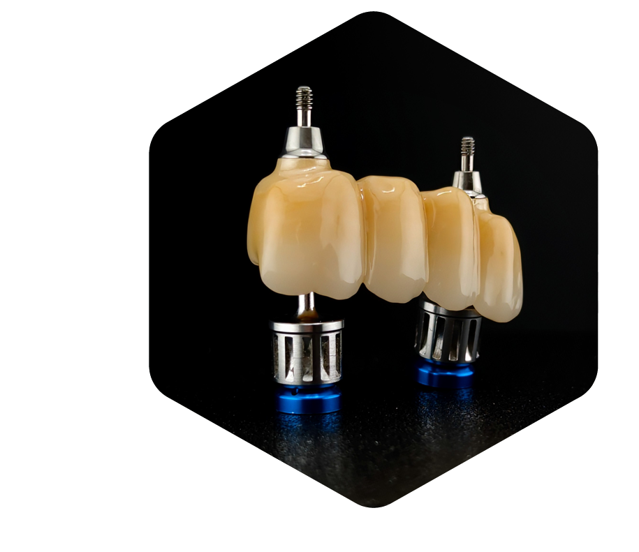 HEXdent LAB - Centrum usług protetycznych